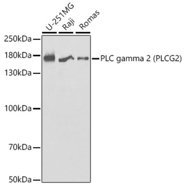 Western Blot - Anti-PLCG 2 Antibody (A13937) - Antibodies.com