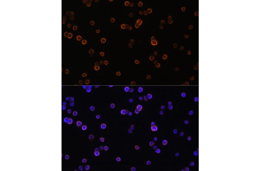 Immunofluorescence - Anti-PLCG 2 Antibody (A13937) - Antibodies.com