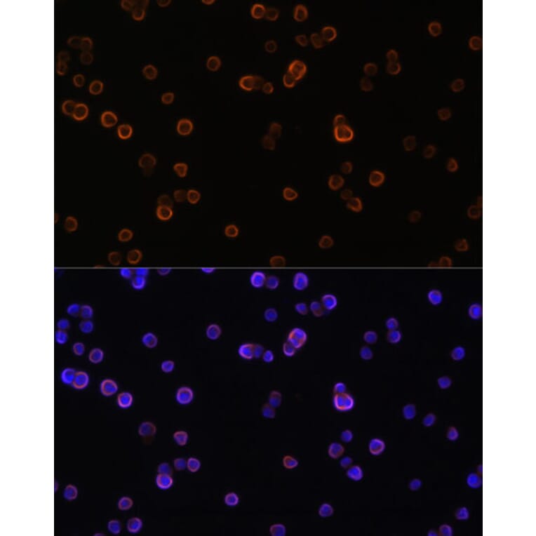 Immunofluorescence - Anti-PLCG 2 Antibody (A13937) - Antibodies.com