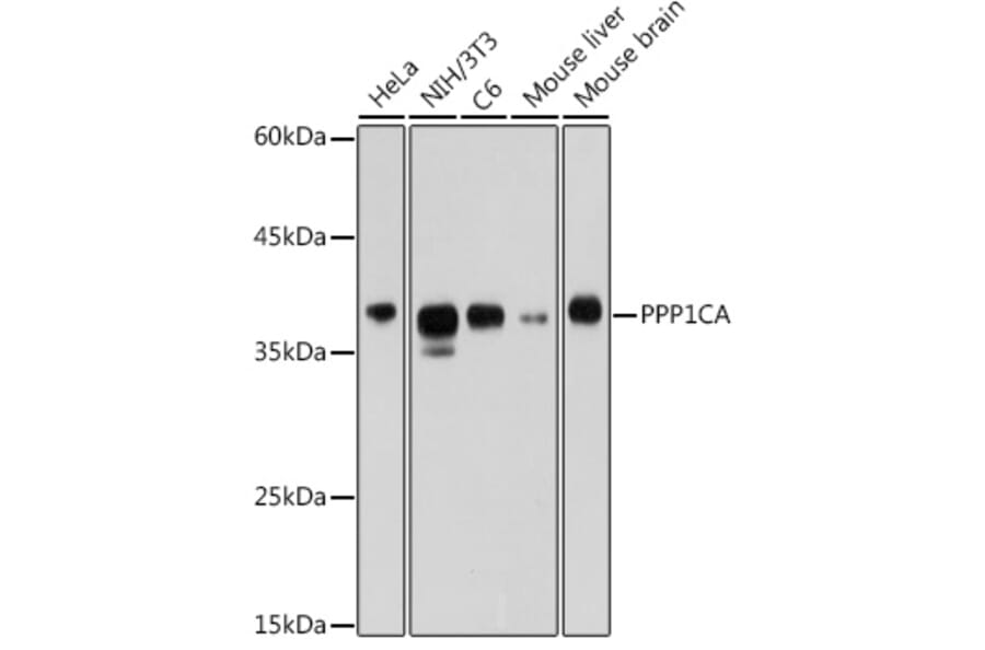 Western Blot - Anti-PPP1CA Antibody (A13938) - Antibodies.com