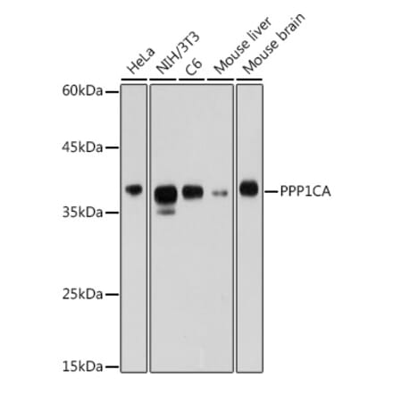 Western Blot - Anti-PPP1CA Antibody (A13938) - Antibodies.com