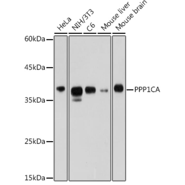 Western Blot - Anti-PPP1CA Antibody (A13938) - Antibodies.com