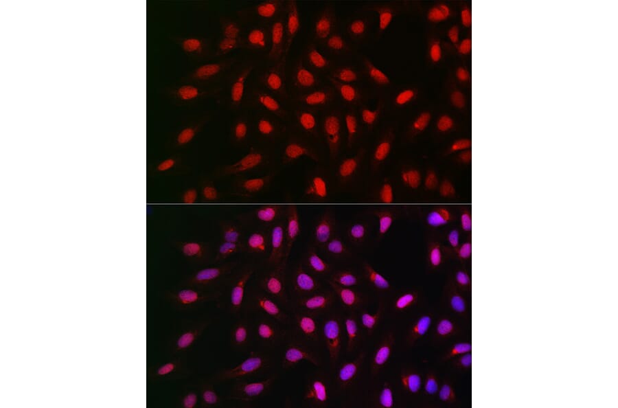 Immunofluorescence - Anti-PPP1CA Antibody (A13938) - Antibodies.com