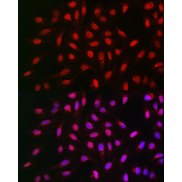 Immunofluorescence - Anti-PPP1CA Antibody (A13938) - Antibodies.com