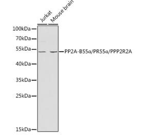 Western Blot - Anti-PPP2R2A Antibody (A13939) - Antibodies.com