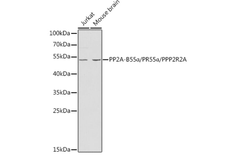 Western Blot - Anti-PPP2R2A Antibody (A13939) - Antibodies.com