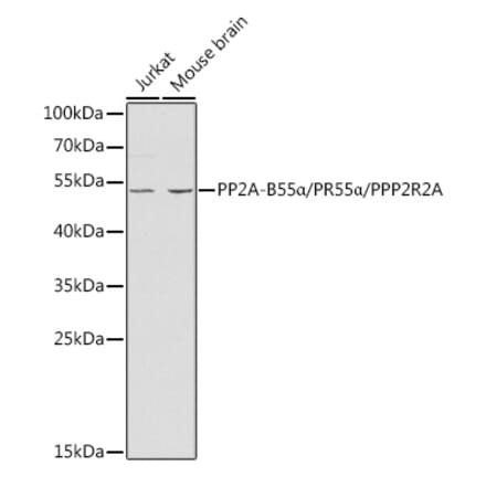 Western Blot - Anti-PPP2R2A Antibody (A13939) - Antibodies.com