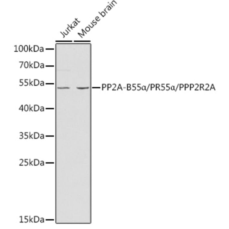 Western Blot - Anti-PPP2R2A Antibody (A13939) - Antibodies.com