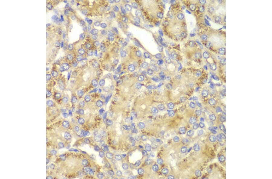 Immunohistochemistry - Anti-PPP2R2A Antibody (A13939) - Antibodies.com