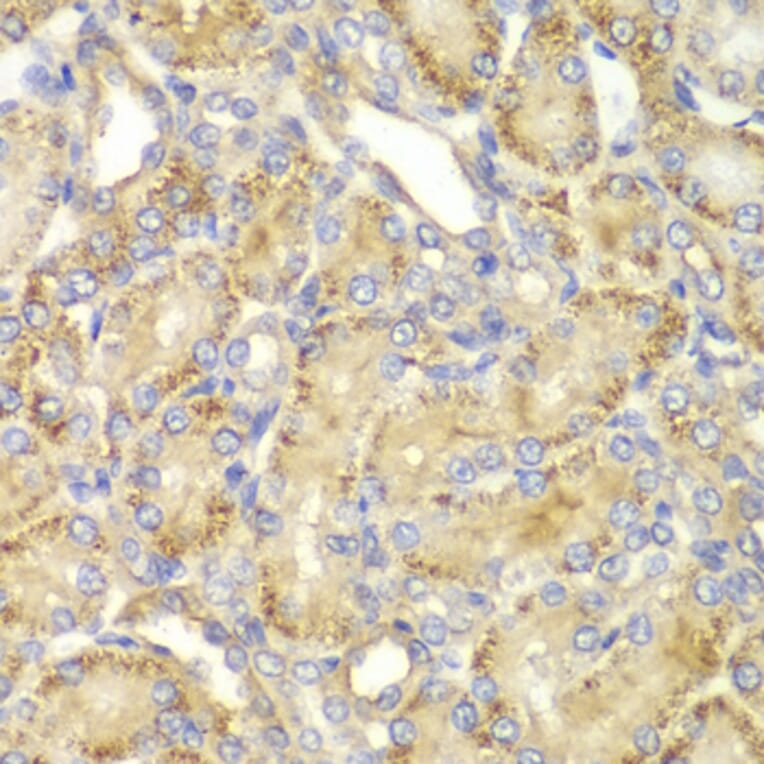 Immunohistochemistry - Anti-PPP2R2A Antibody (A13939) - Antibodies.com