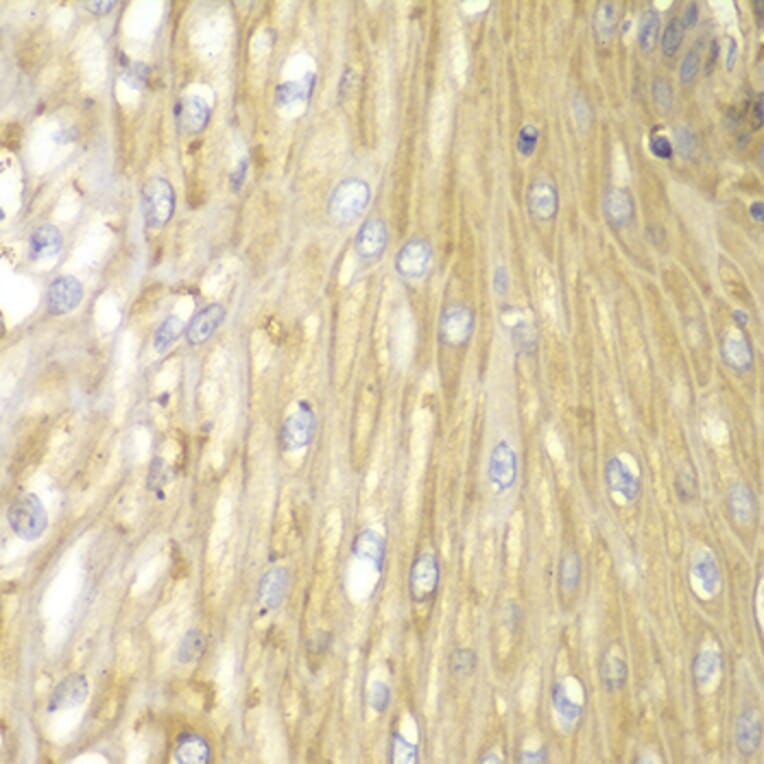 Immunohistochemistry - Anti-PPP2R2A Antibody (A13939) - Antibodies.com