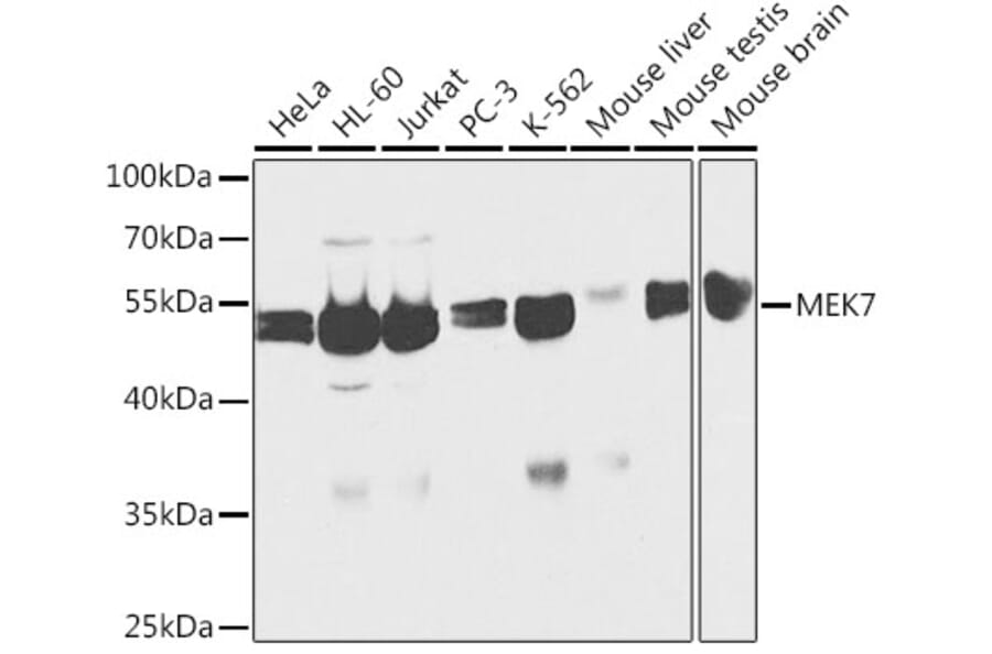 Western Blot - Anti-MKK7 Antibody (A13940) - Antibodies.com