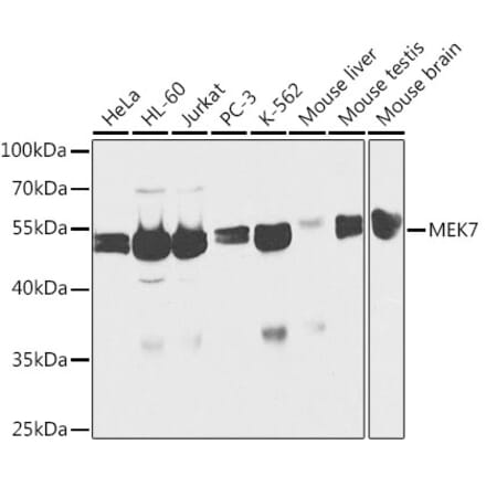 Western Blot - Anti-MKK7 Antibody (A13940) - Antibodies.com