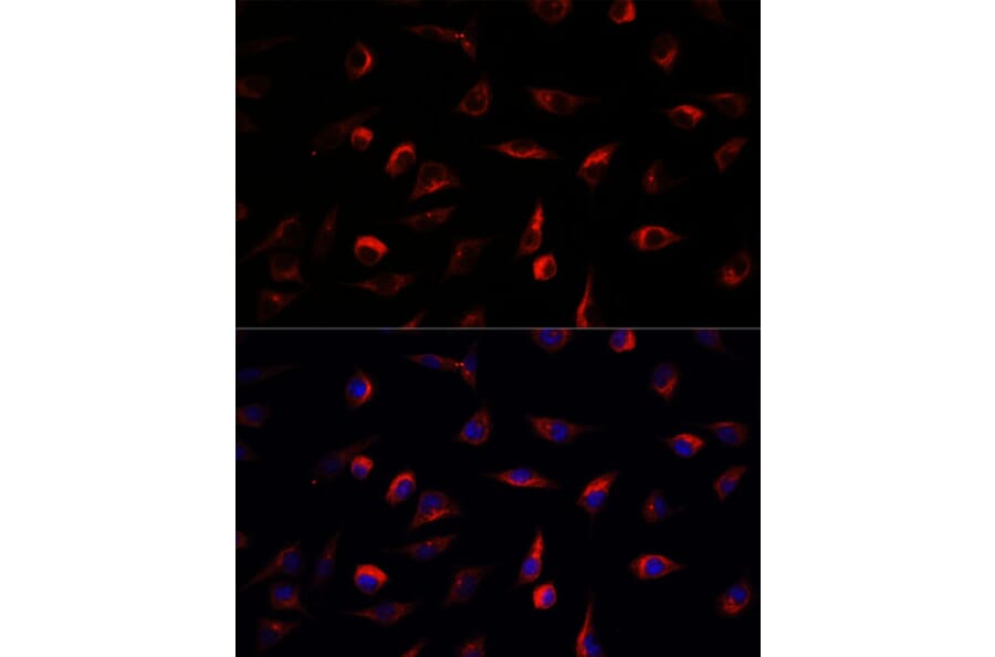 Immunofluorescence - Anti-MKK7 Antibody (A13940) - Antibodies.com