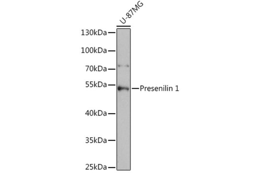 Western Blot - Anti-Presenilin 1/PS-1 Antibody (A13941) - Antibodies.com