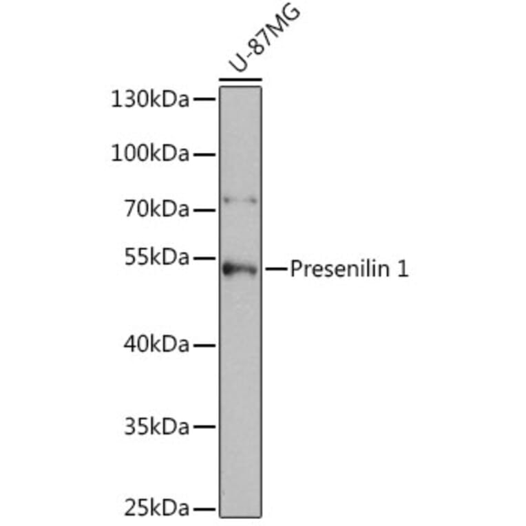 Western Blot - Anti-Presenilin 1/PS-1 Antibody (A13941) - Antibodies.com
