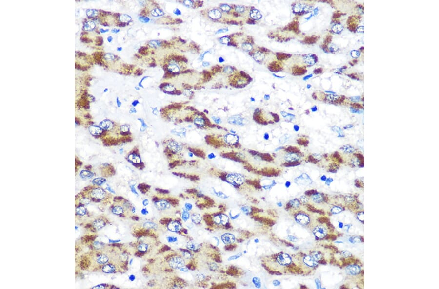 Immunohistochemistry - Anti-Presenilin 1/PS-1 Antibody (A13941) - Antibodies.com
