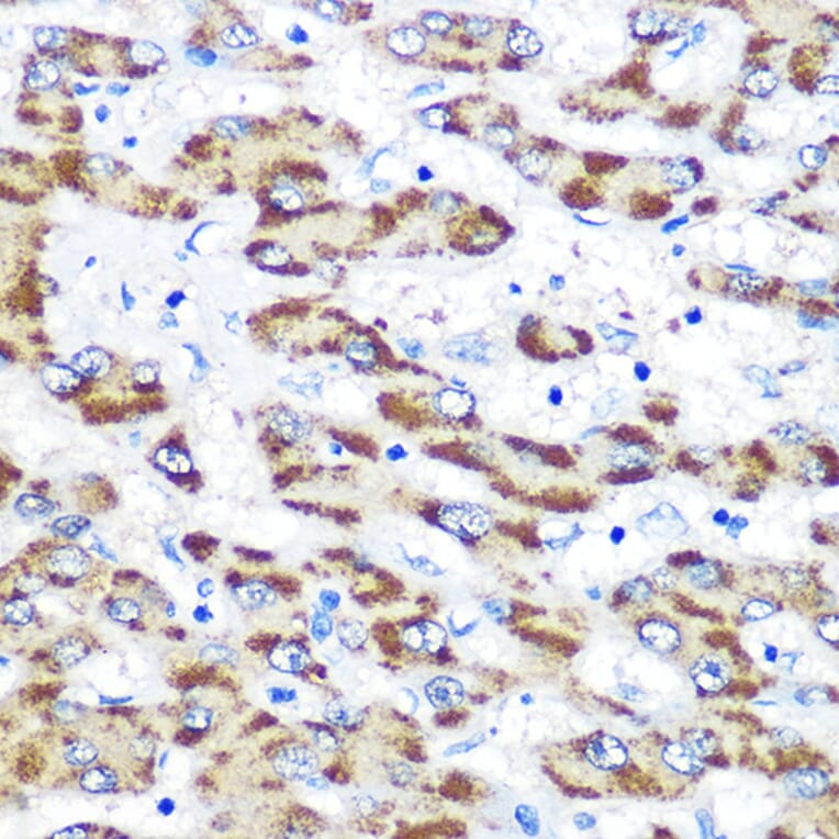 Immunohistochemistry - Anti-Presenilin 1/PS-1 Antibody (A13941) - Antibodies.com