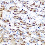 Immunohistochemistry - Anti-Presenilin 1/PS-1 Antibody (A13941) - Antibodies.com