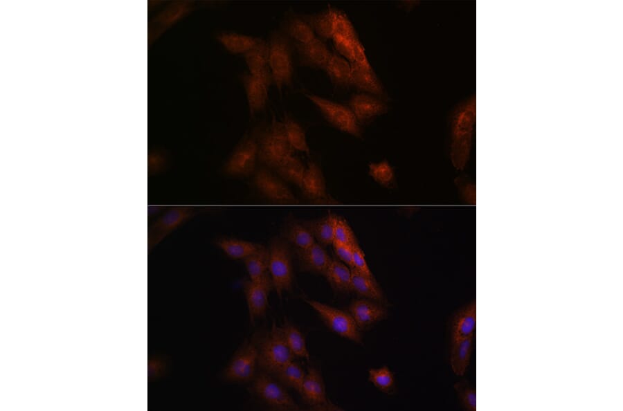 Immunofluorescence - Anti-Presenilin 1/PS-1 Antibody (A13941) - Antibodies.com