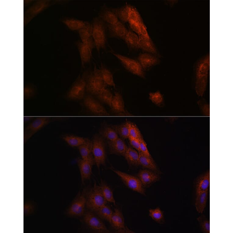 Immunofluorescence - Anti-Presenilin 1/PS-1 Antibody (A13941) - Antibodies.com