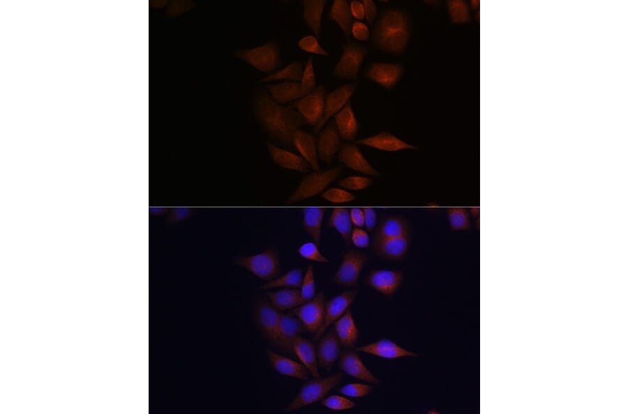 Immunofluorescence - Anti-Presenilin 1/PS-1 Antibody (A13941) - Antibodies.com