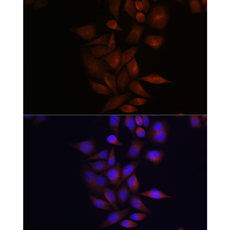 Immunofluorescence - Anti-Presenilin 1/PS-1 Antibody (A13941) - Antibodies.com