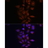Immunofluorescence - Anti-Presenilin 1/PS-1 Antibody (A13941) - Antibodies.com