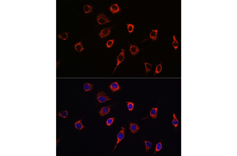 Immunofluorescence - Anti-Presenilin 1/PS-1 Antibody (A13941) - Antibodies.com