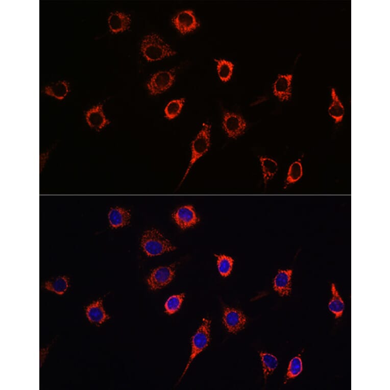 Immunofluorescence - Anti-Presenilin 1/PS-1 Antibody (A13941) - Antibodies.com