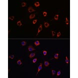 Immunofluorescence - Anti-Presenilin 1/PS-1 Antibody (A13941) - Antibodies.com
