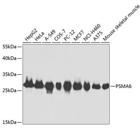 Western Blot - Anti-Proteasome subunit alpha type 6 Antibody (A13942) - Antibodies.com