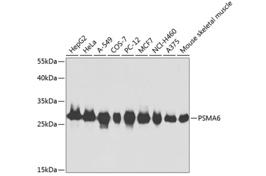 Western Blot - Anti-Proteasome subunit alpha type 6 Antibody (A13942) - Antibodies.com