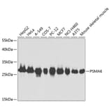 Western Blot - Anti-Proteasome subunit alpha type 6 Antibody (A13942) - Antibodies.com