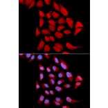 Immunofluorescence - Anti-Proteasome subunit alpha type 6 Antibody (A13942) - Antibodies.com