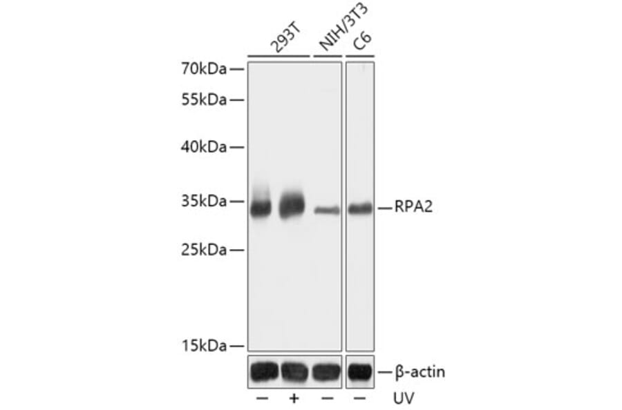 Western Blot - Anti-RPA32 / RPA2 Antibody (A13943) - Antibodies.com