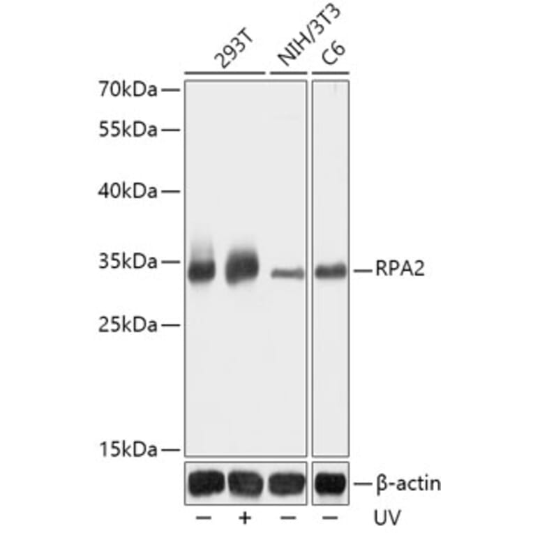 Western Blot - Anti-RPA32 / RPA2 Antibody (A13943) - Antibodies.com