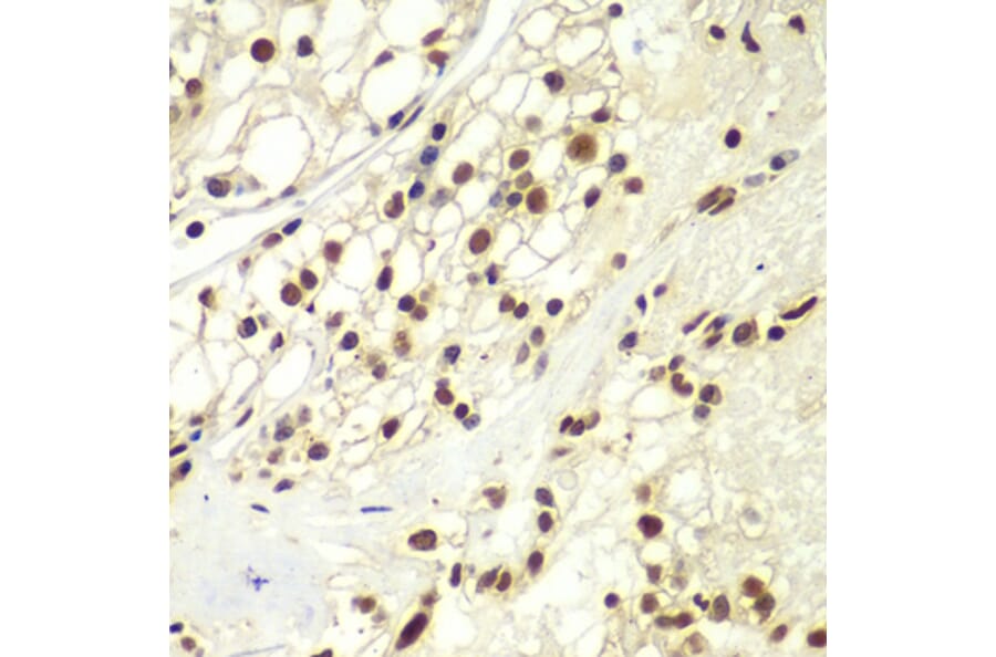 Immunohistochemistry - Anti-RPA32 / RPA2 Antibody (A13943) - Antibodies.com