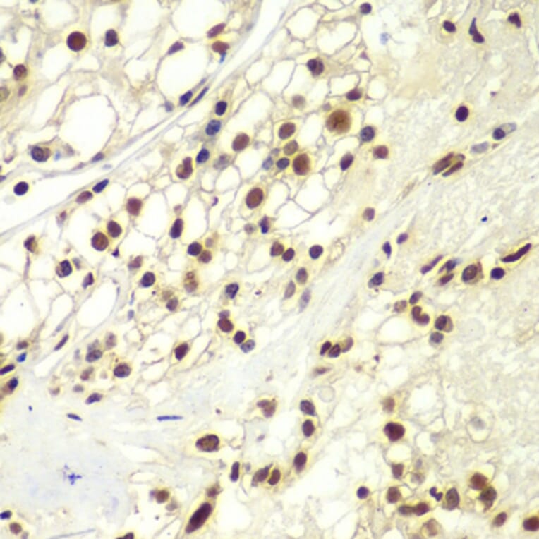 Immunohistochemistry - Anti-RPA32 / RPA2 Antibody (A13943) - Antibodies.com