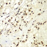 Immunohistochemistry - Anti-RPA32 / RPA2 Antibody (A13943) - Antibodies.com