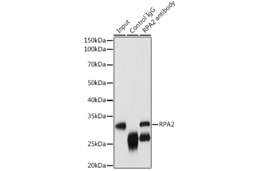 Western Blot - Anti-RPA32 / RPA2 Antibody (A13943) - Antibodies.com