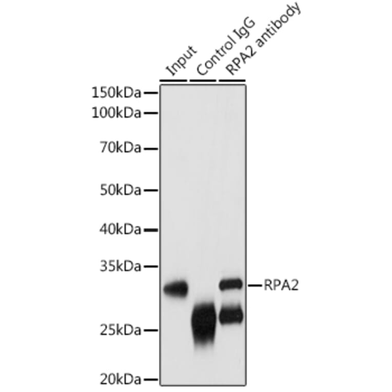 Western Blot - Anti-RPA32 / RPA2 Antibody (A13943) - Antibodies.com