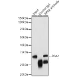 Western Blot - Anti-RPA32 / RPA2 Antibody (A13943) - Antibodies.com
