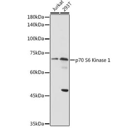 Western Blot - Anti-S6K1 Antibody (A13944) - Antibodies.com