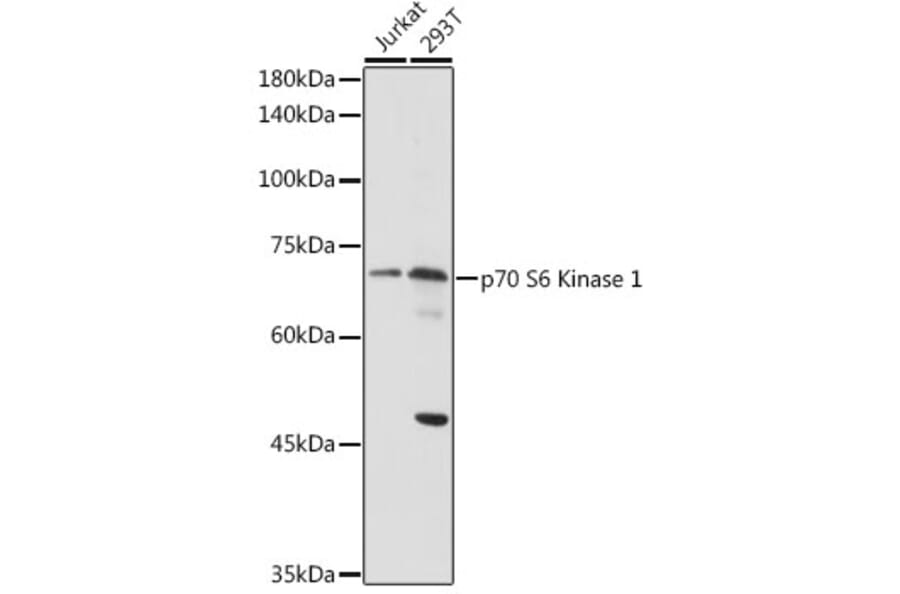 Western Blot - Anti-S6K1 Antibody (A13944) - Antibodies.com