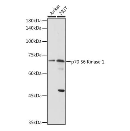 Western Blot - Anti-S6K1 Antibody (A13944) - Antibodies.com