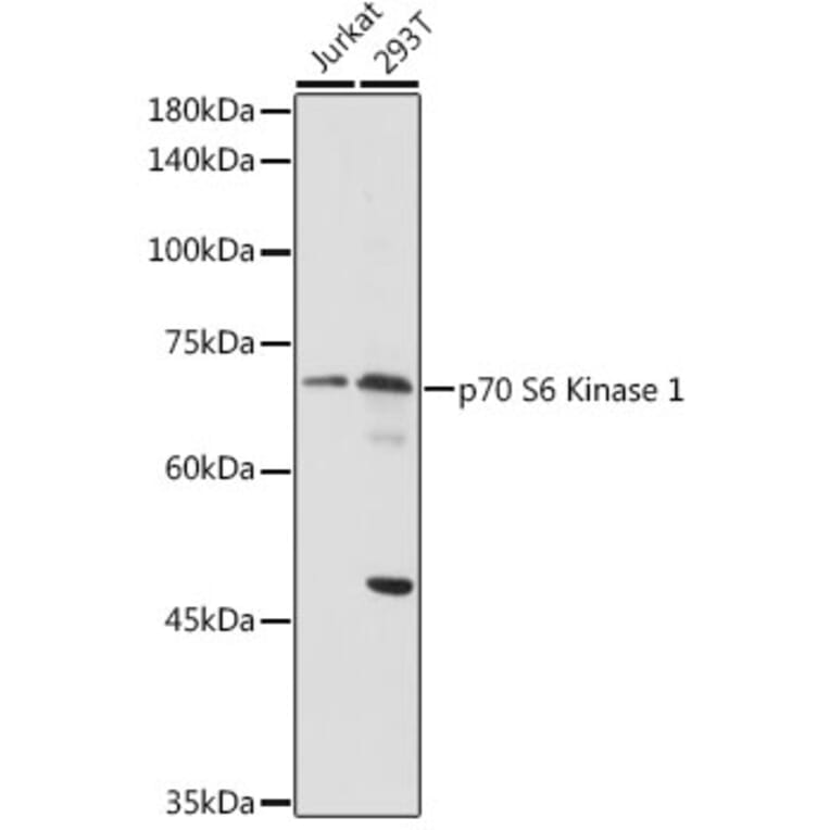 Western Blot - Anti-S6K1 Antibody (A13944) - Antibodies.com