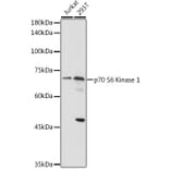 Western Blot - Anti-S6K1 Antibody (A13944) - Antibodies.com