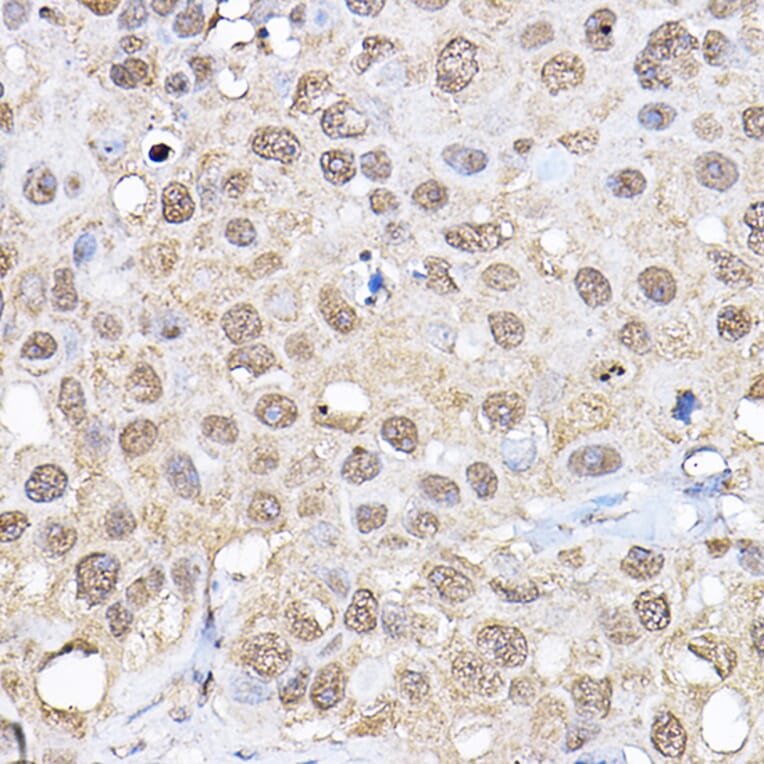 Immunohistochemistry - Anti-S6K1 Antibody (A13944) - Antibodies.com