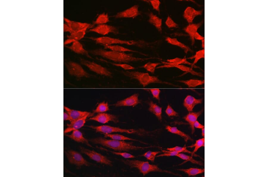 Immunofluorescence - Anti-S6K1 Antibody (A13944) - Antibodies.com
